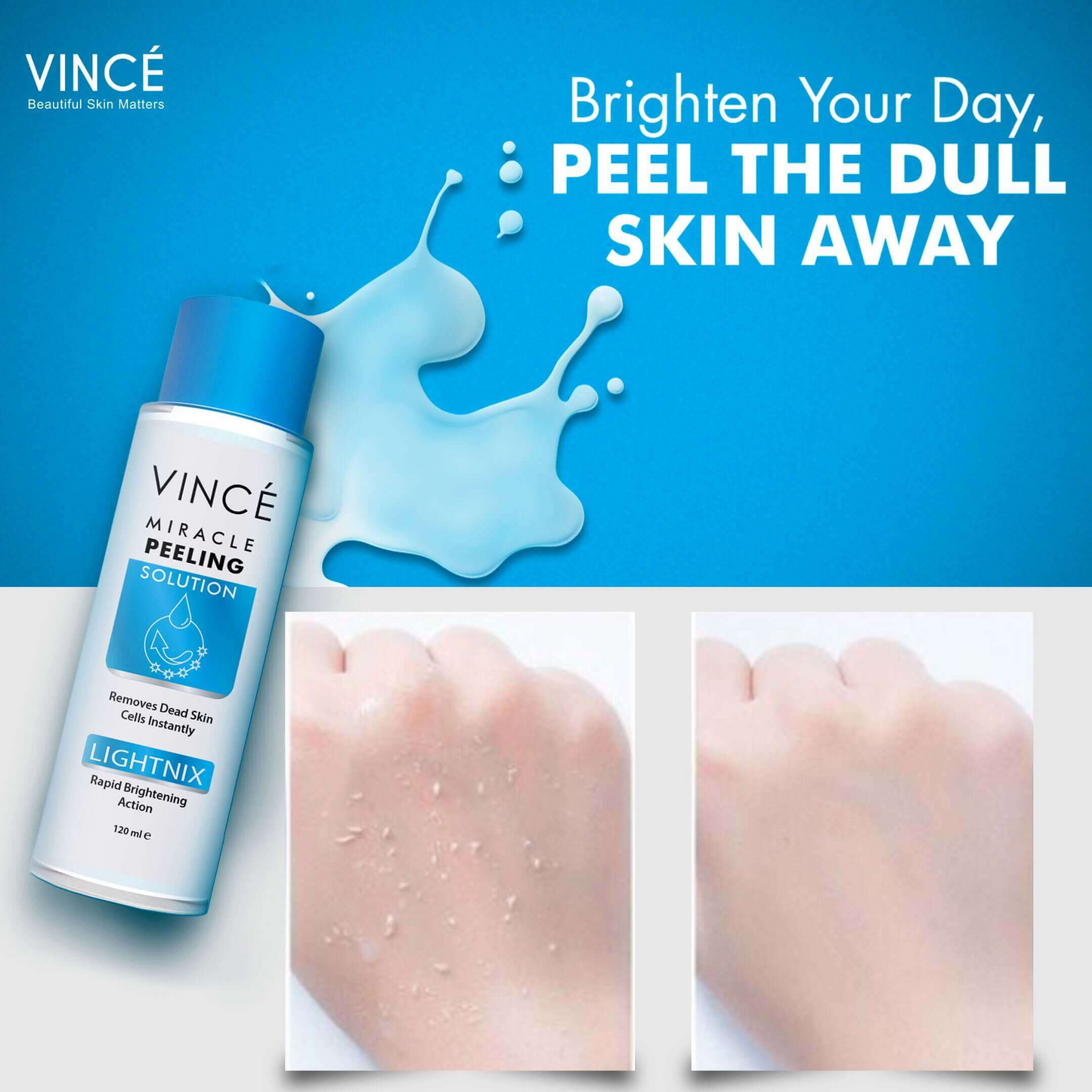Vince - Miracle Peeling Solution